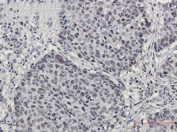 Cullin 4A/4B Rabbit mAb Antibody