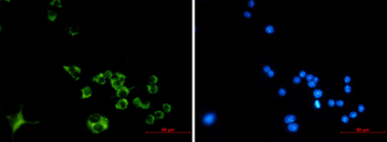 Cathepsin B Rabbit mAb Antibody