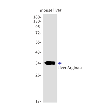 Liver Arginase Rabbit mAb Antibody