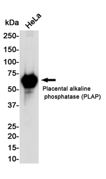 Placental Alkaline Phosphatase Rabbit mAb Antibody