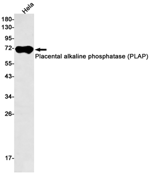 Placental Alkaline Phosphatase Rabbit mAb Antibody