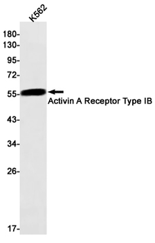 Activin A Receptor Type IB Rabbit mAb Antibody