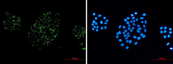 ACOX1 Rabbit Monoclonal Antibody