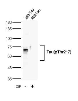 Recombinant Tau(Phospho-Thr217) Rabbit mAb(G122) Antibody