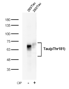 Recombinant Tau(Phospho-Thr181) Rabbit mAb(G69) Antibody