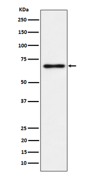 NR2C2 / TR4 Rabbit mAb Antibody
