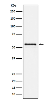 PTBP2 Rabbit mAb Antibody
