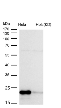 DUT Rabbit mAb Antibody