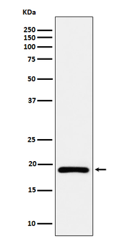 DUT Rabbit mAb Antibody