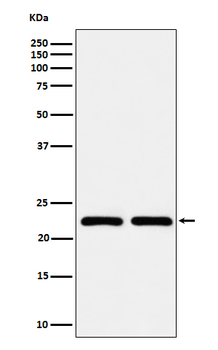 RAB22A Rabbit mAb