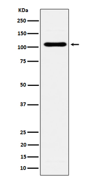 EXOC2 Rabbit Monoclonal Antibody