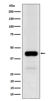 NFE2 Rabbit mAb Antibody