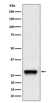 PDGF B Rabbit mAb Antibody