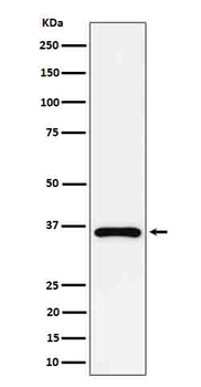 GAS2 Rabbit mAb Antibody