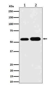 AKT1/2/3 Rabbit mAb Antibody