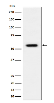 Vimentin (Phospho-S39) Rabbit mAb Antibody