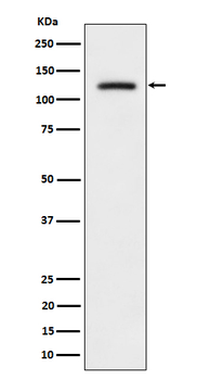 ULK1 (Phospho-Ser556) Rabbit mAb Antibody