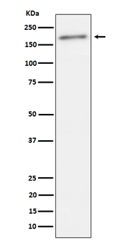 ErbB2(Phospho-Tyr1221 / Tyr1222) Rabbit mA Antibody