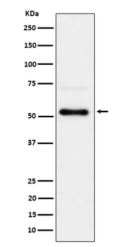 Chk1 (Phospho-Ser280) Rabbit mAb Antibody