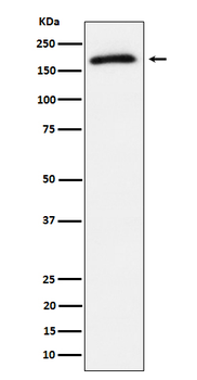 AS160 (Phospho-Thr642) Rabbit mAb Antibody