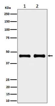 NDUFS2 Rabbit mAb Antibody