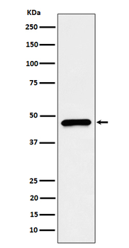 CECR5 Rabbit mAb Antibody