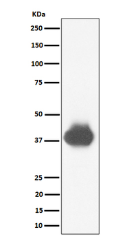 CD32A + CD32B + CD32C Rabbit mAb Antibody