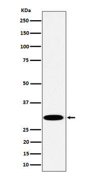 TPMT Rabbit mAb Antibody
