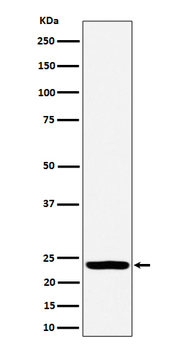 DTYMK Rabbit mAb Antibody