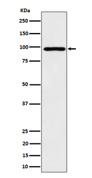 AKAP 95 Rabbit mAb [KD Validated] Antibody