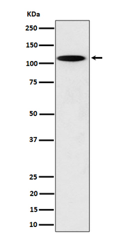 N4BP1 Rabbit mAb Antibody