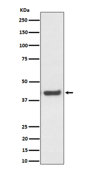 MVK Rabbit Monoclonal Antibody