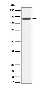 R Cadherin Rabbit mAb
