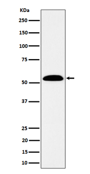 ALDH7A1 Rabbit mAb Antibody