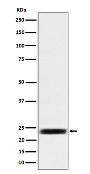 ARFRP1/ARP Rabbit Monoclonal Antibody