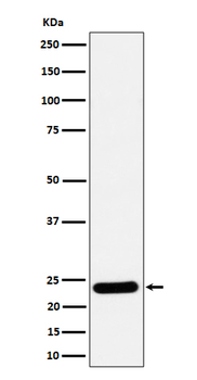 RAB5C / RABL Rabbit mAb Antibody