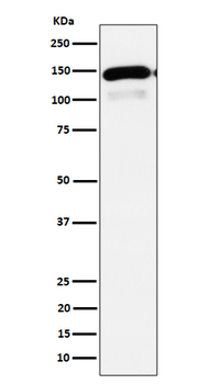 PLCB1 Rabbit Monoclonal Antibody
