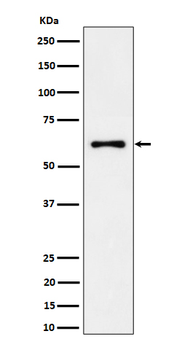 EYA2 Rabbit Monoclonal Antibody