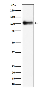 Thrombomodulin / CD141 Rabbit mAb Antibody