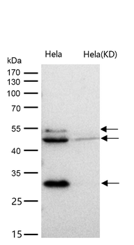 Bag1 Rabbit mAb [KD Validated] Antibody