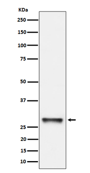 PNMT Rabbit Monoclonal Antibody
