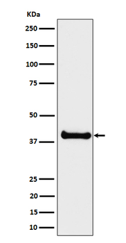 ALS2CR1 Rabbit Monoclonal Antibody