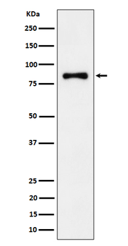 ALDH16A1 Rabbit mAb Antibody
