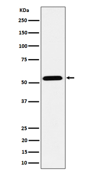 ENPP5 Rabbit mAb