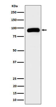 TRPV5 Rabbit Monoclonal Antibody