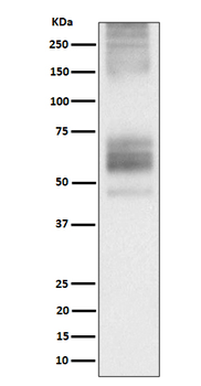 Somatostatin Receptor 1 Rabbit mAb Antibody