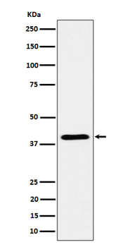 ADH4 Rabbit mAb Antibody
