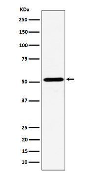 NPY5R Rabbit mAb Antibody