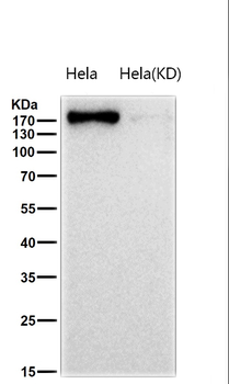 AGL Rabbit mAb [KD Validated] Antibody