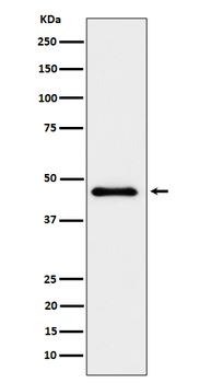 ELP4 Rabbit mAb Antibody